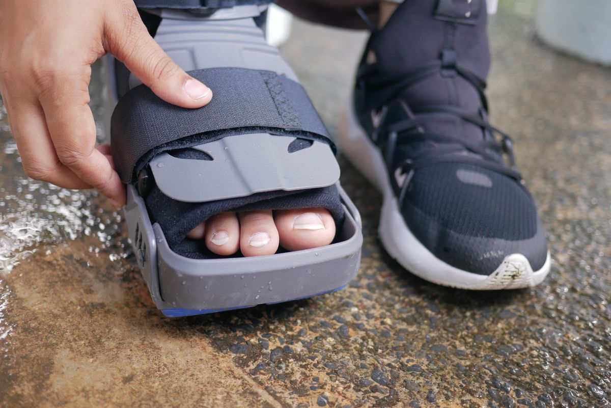 Stopa w ortezie typu walker zapinanej na rzepy, obok but sportowy na drugiej nodze